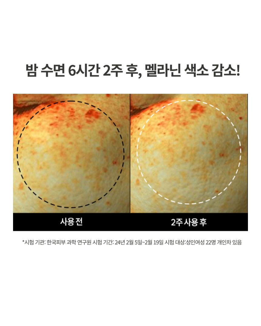 DOMINAS - Dark Spot & Melasma Cream (Tranexamic Acid) [K-Pharmacy Item]