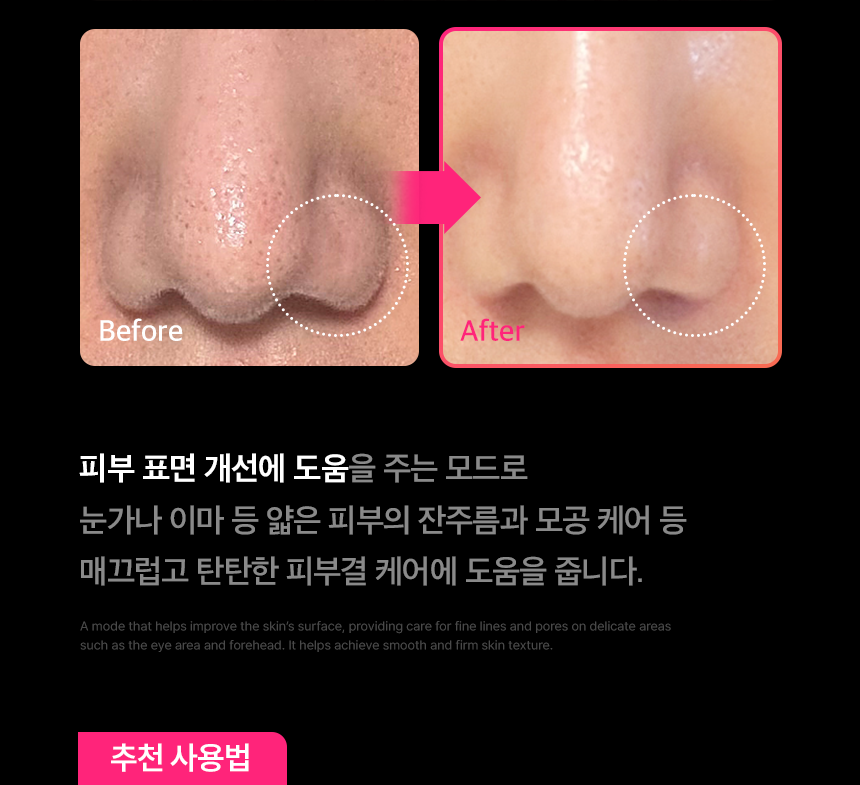 THERMATHERA - Unlimited-Shot HIFU Beauty Device [New Launch!]