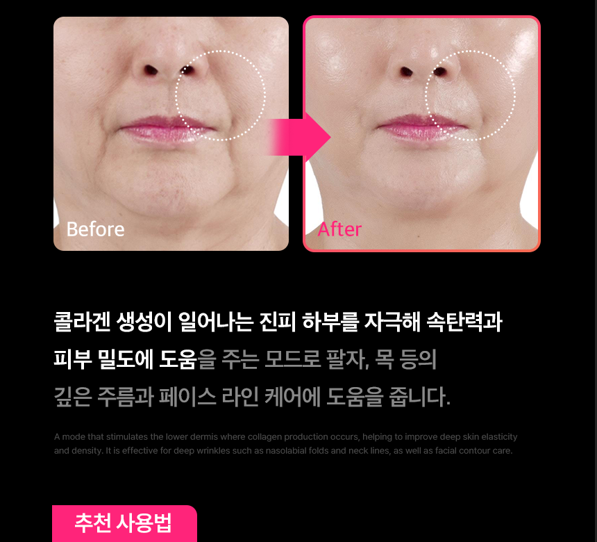 THERMATHERA - Unlimited-Shot HIFU Beauty Device [New Launch!]