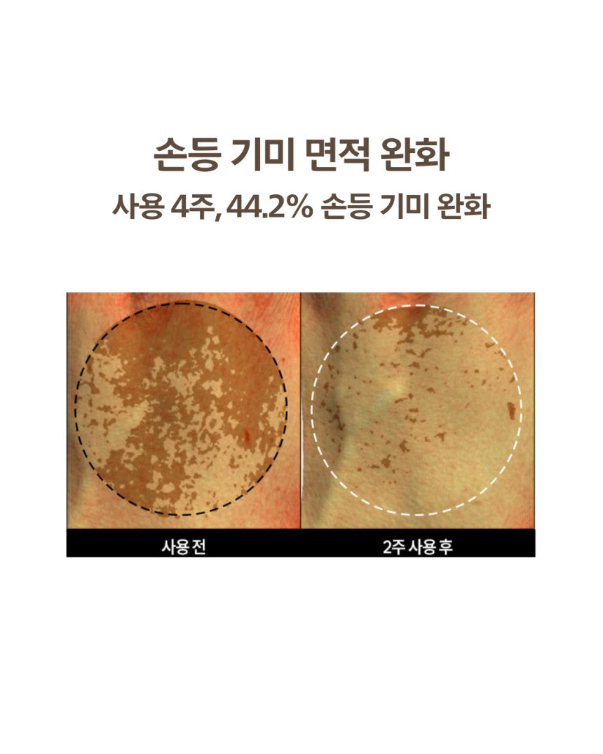 DOMINAS - Dark Spot & Melasma Cream (Tranexamic Acid) [K-Pharmacy Item]