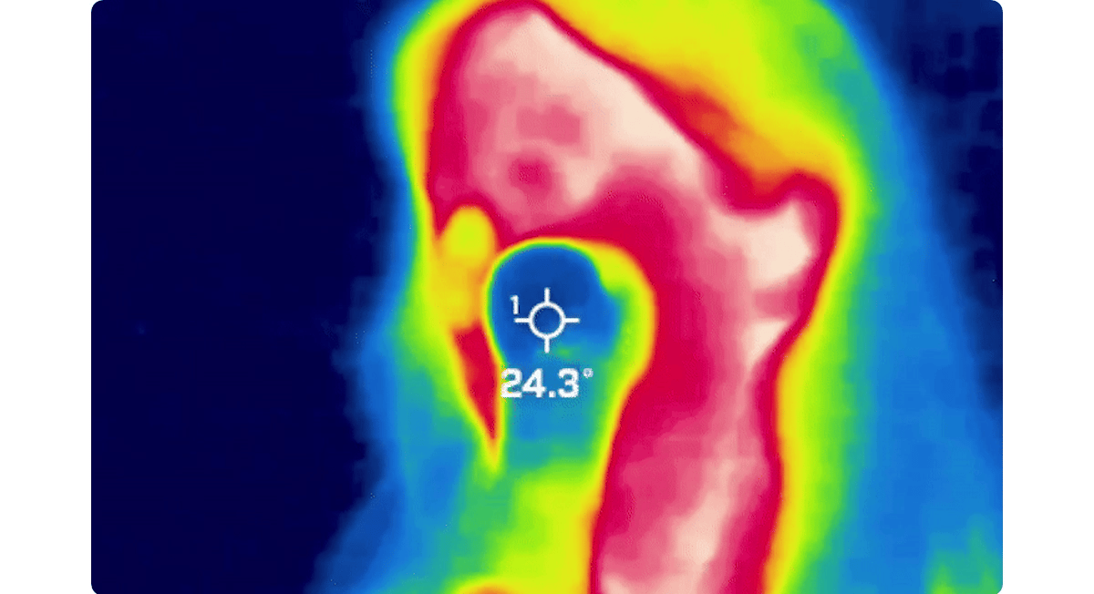 [Glow.M] Cryo Sonic Pro (Cooling, Firming & Radiance Care)