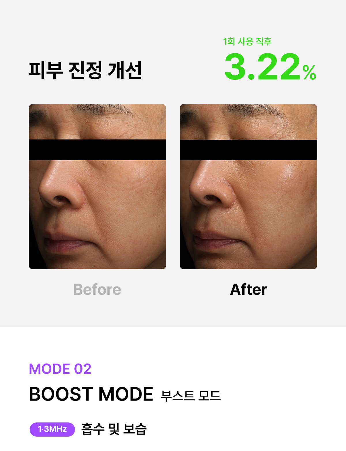 [Glow.M] Cryo Sonic Pro (Cooling, Firming & Radiance Care)