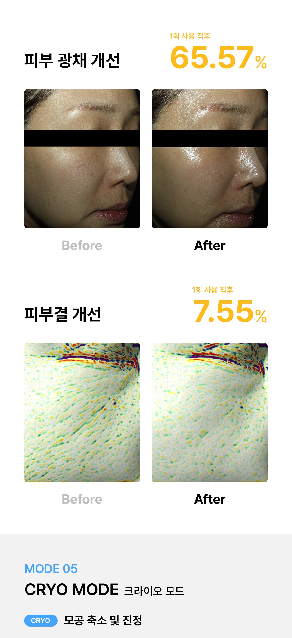 [Glow.M] Cryo Sonic Pro (Cooling, Firming & Radiance Care)