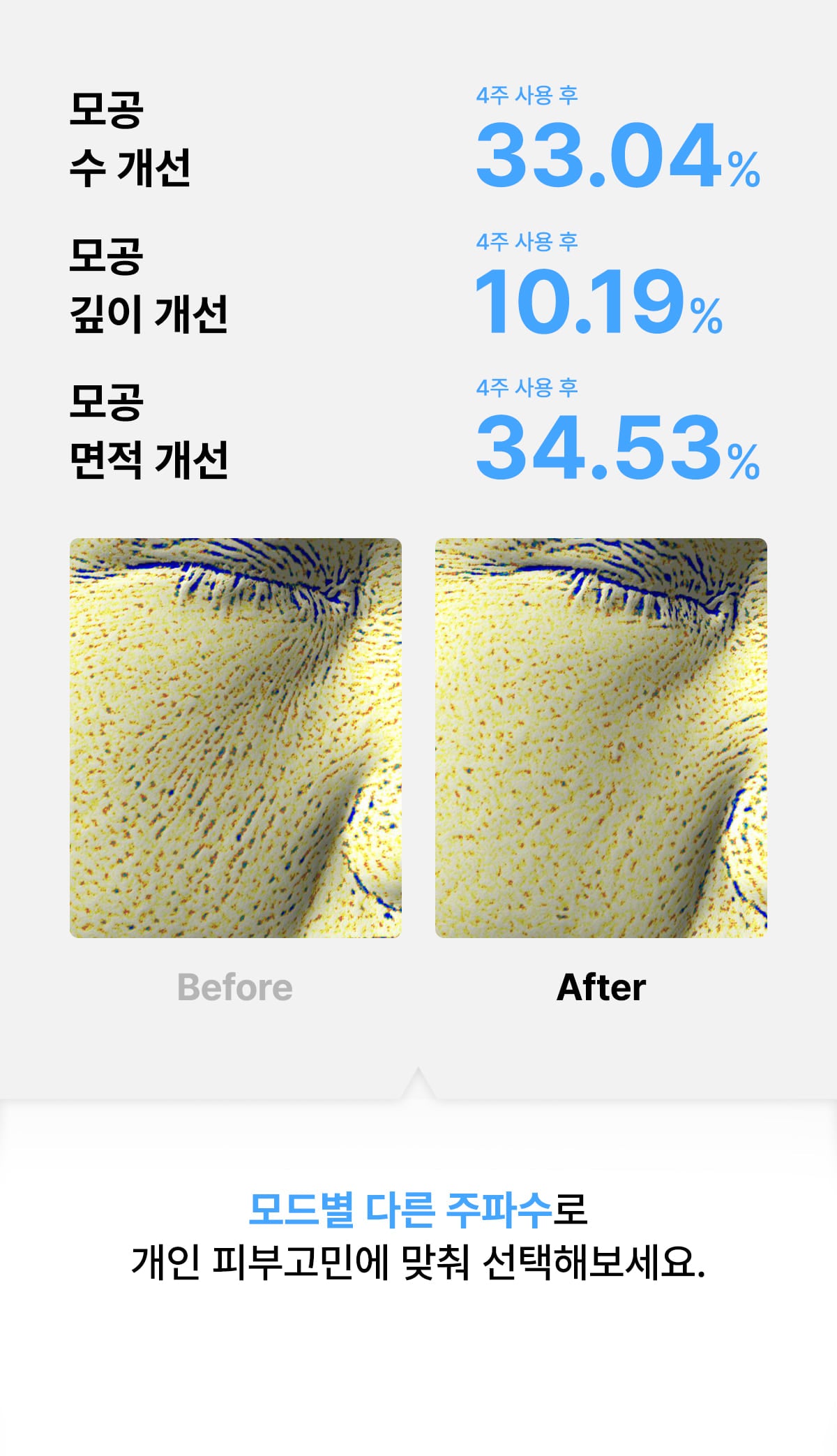 [Glow.M] Cryo Sonic Pro (Cooling, Firming & Radiance Care)