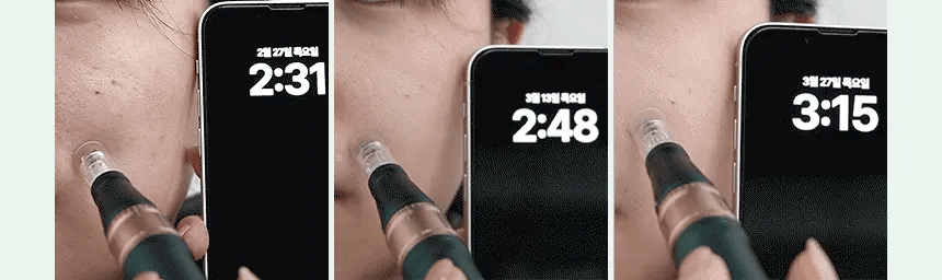 VUDE - Ultra-Low Molecular Diva Shot (Pore Care Beauty Device)