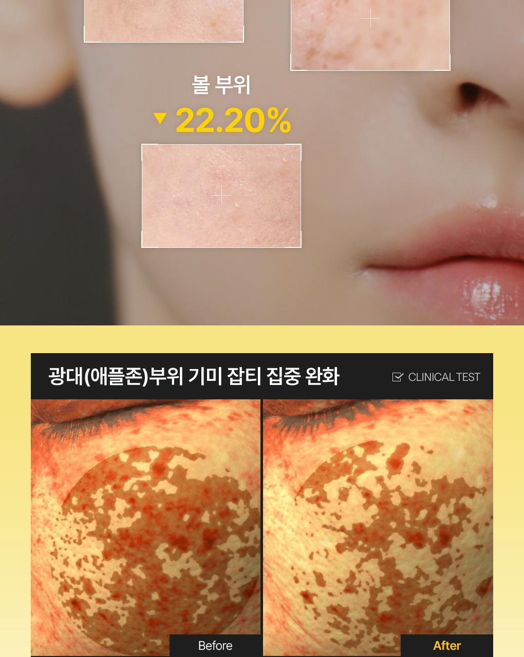 MEDIHEAL - Collagen Capsule Patch (60 Sheets)