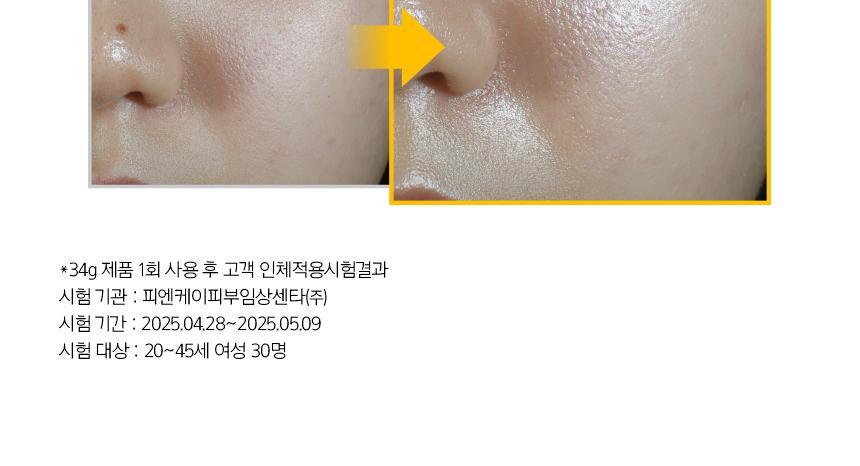 prmr - Vitatinol Serum Mega-Shot Gel Mask (4+1 Sheets)