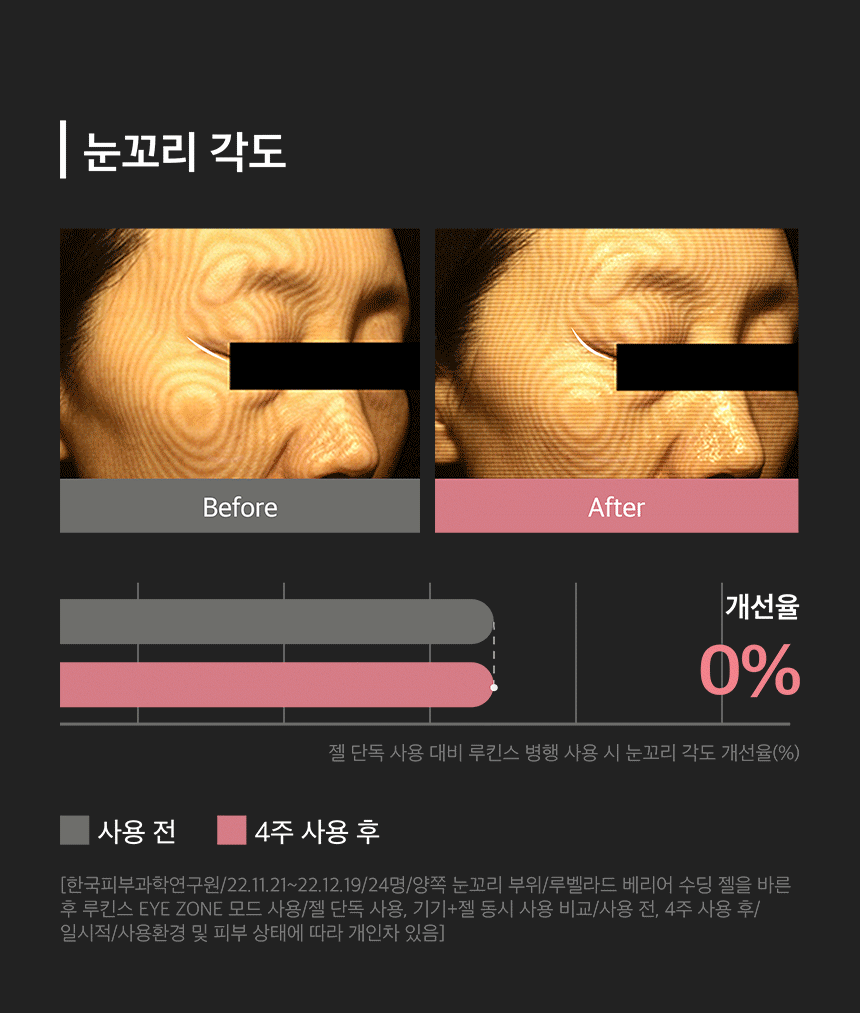 LUKINS - Pro Beauty Device [New Launch!]