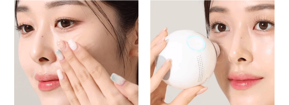 HOMETHERA Innolif Infinite-Shot HIFU Lifting Device