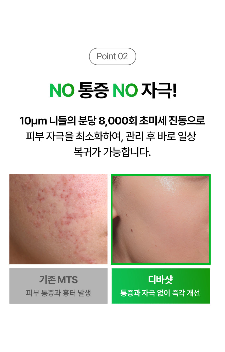 VUDE - Ultra-Low Molecular Diva Shot (Pore Care Beauty Device)